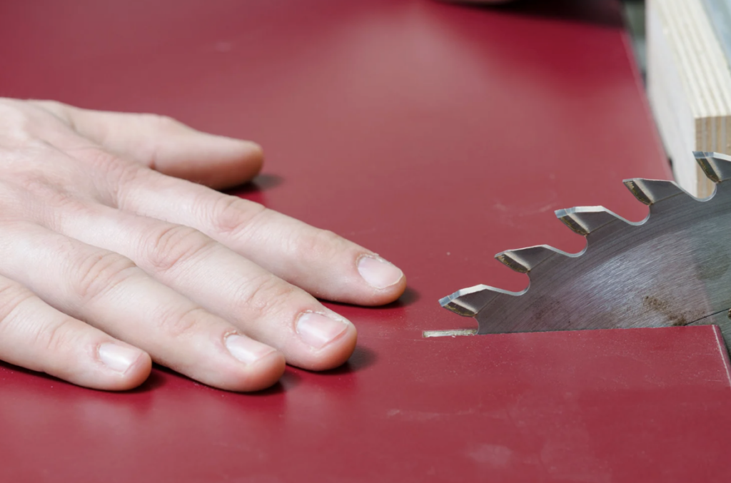 İş Kazası Niteliğindeki Darp Olaylarında Ceza Dosyasının Rücu ve Tazminat Davalarına Etkisi